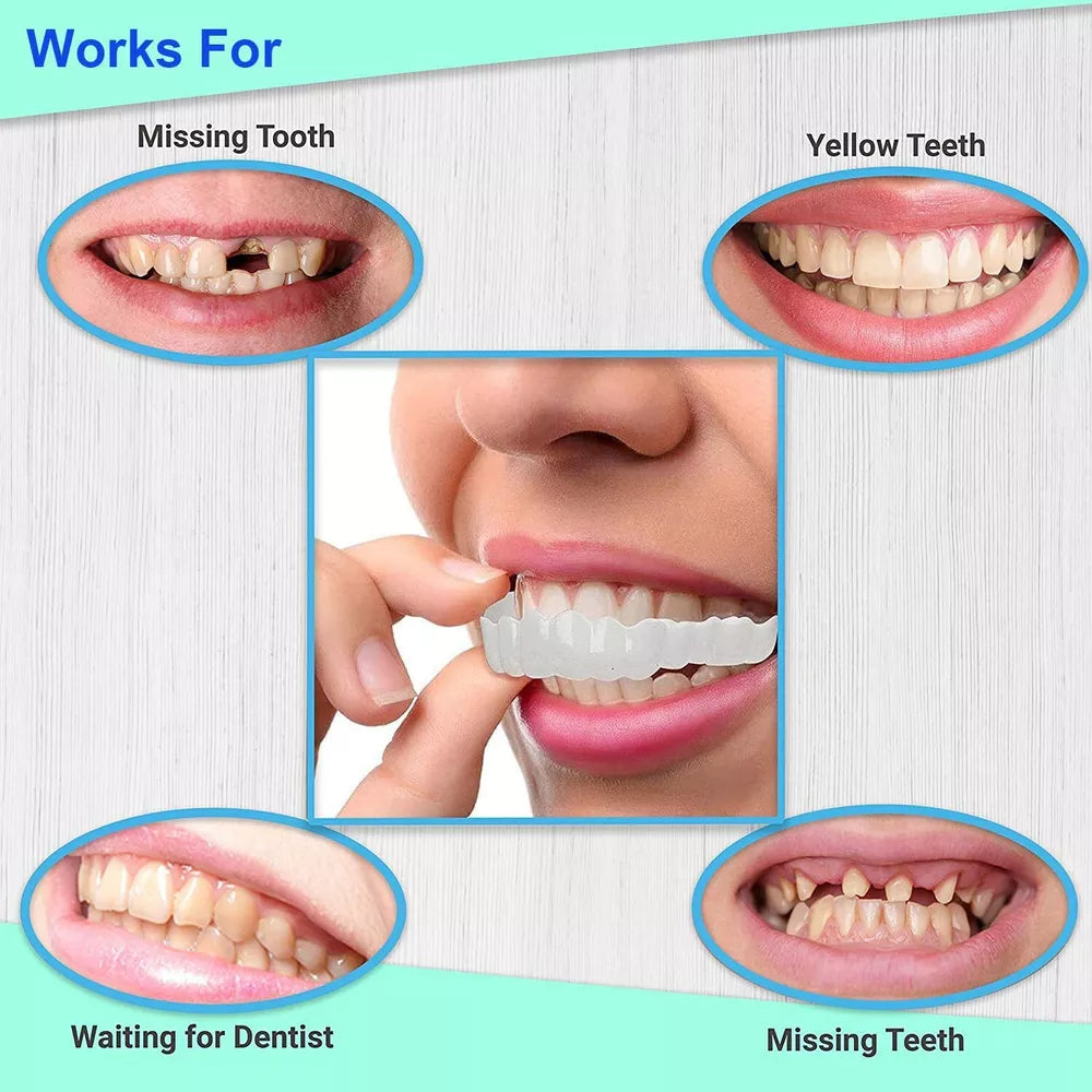 Facette de Sourire Instantanée - Transformez Votre Sourire avec Confiance